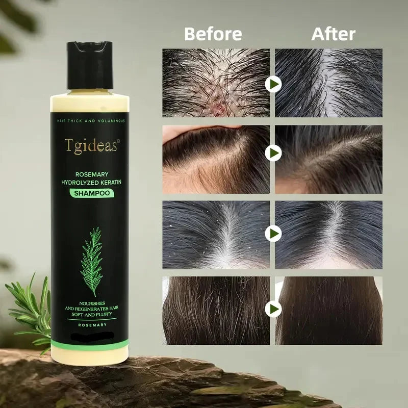 Rosemary Shampoo | Hair Growth & Anti-Dandruff Scalp Treatment