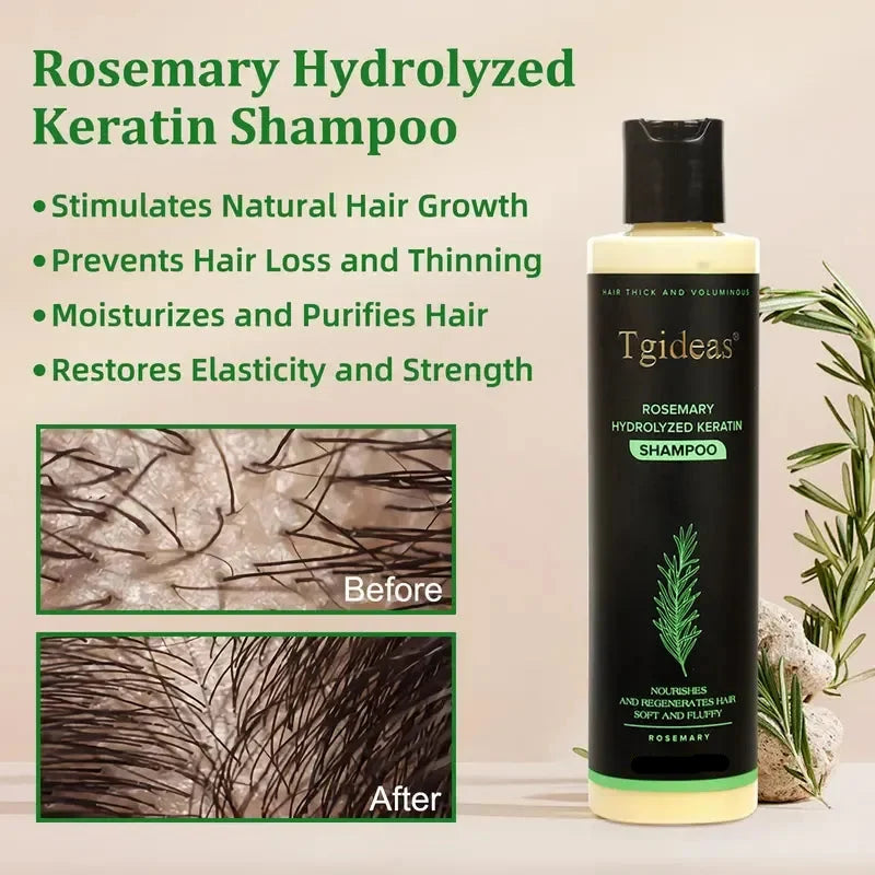 🌿🌿Rosemary Shampoo | Hair Growth & Anti-Dandruff Scalp Treatment