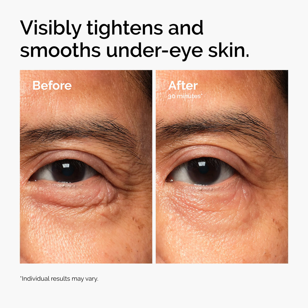👁️✨ The Ordinary Lacto-PDRN* 4% + B9 Eye Cream 🧴